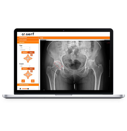 Software de planificación - SERF - para ortopedia / para tablet PC