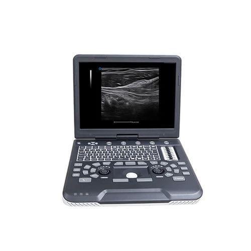 Ecógrafo portátil - Apogee 1000 - SIUI - para ecografía polivalente / doppler-color
