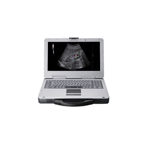Ecógrafo portátil - Apogee 1000 Plus - SIUI - para ecografía polivalente / doppler-color / blanco y negro