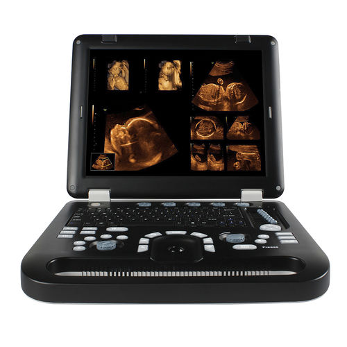 Ecógrafo portátil - CMS1700A - Sino-Hero - para ecografía polivalente / blanco y negro / 3D/4D