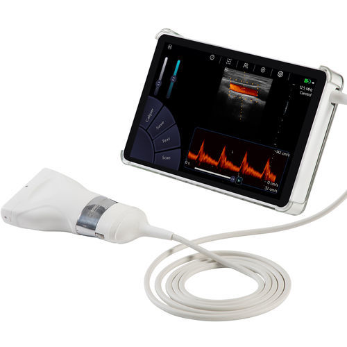 Ecógrafo de mano - U-Lite PRO - Sonoscanner - para ecografías abdominales y pélvicas / para ecografía polivalente / para ecocardiografía de estrés farmacológico