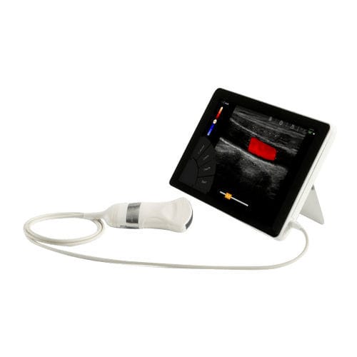 Ecógrafo portátil - T-Lite - Sonoscanner - para ecografías abdominales y pélvicas / para ecografía polivalente / para ecografía ginecológica y obstétrica