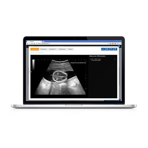 Software de análisis - Sonoscanner - Sonoscanner - para imágenes médicas