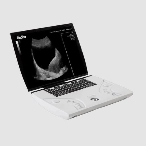 Ecógrafo portátil, con carro - Orcheo Lite TE - Sonoscanner - para ecografía polivalente / blanco y negro