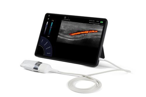 Sonda para ecografía lineal - Sonoscanner - musculoesquelética / para partes pequeñas / vascular