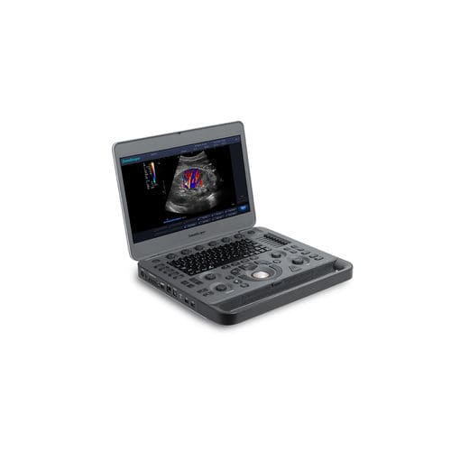 Ecógrafo portátil - X3 - SonoScape - para ecografía polivalente / blanco y negro / doppler-color