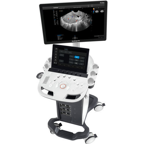 Ecógrafo con soporte, compacto - P9 Elite - SonoScape - para ecografía polivalente / blanco y negro / doppler-color