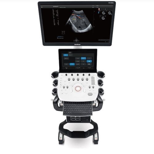 Ecógrafo con soporte - P25 Elite - SonoScape - para ecografía ginecológica y obstétrica / para ecografías abdominales y pélvicas / para ecografía cardiovascular