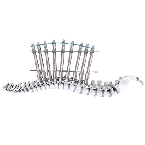 Sistema de posicionamiento de tornillos pediculares - mont blanc 3D+ - Spineway