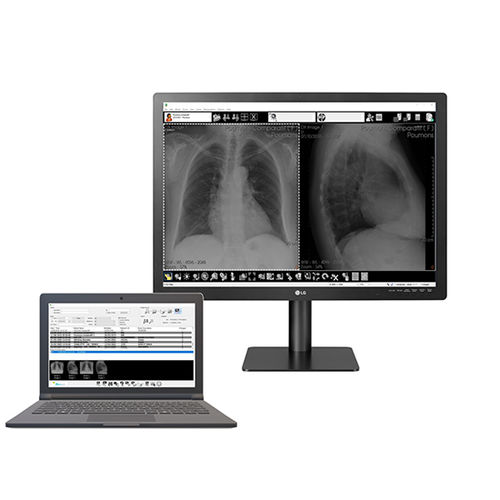Software de radiología - Med Diag - Stephanix - de gestión / de visualización / de diagnóstico