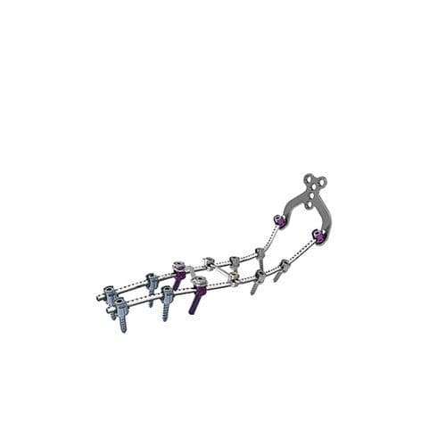 Sistema de osteosíntesis occipitocervicotorácico - OASYS - Stryker - vía posterior / para adulto