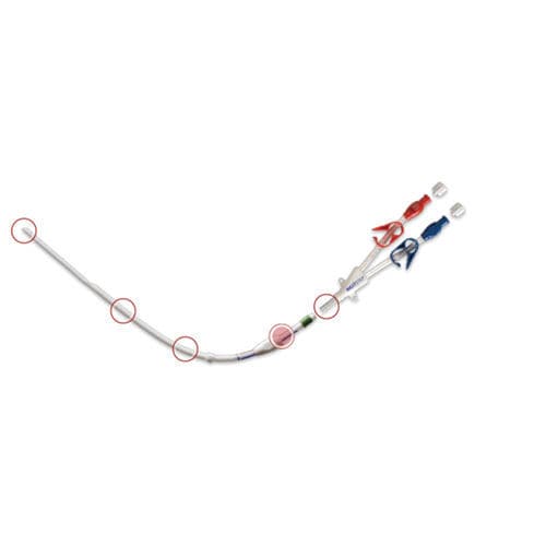 Catéter de acceso - NextStep® Retrograde - Truphatek International - de hemodiálisis / vena yugular / vena subclavia