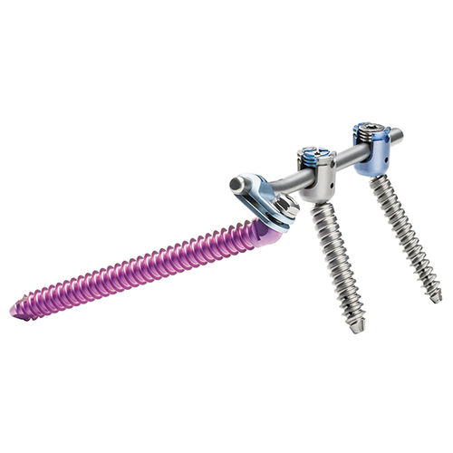 Sistema de osteosíntesis sacroilíaco - uBase™ - ulrich medical - vía posterior / para adulto