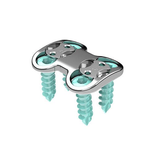 Placa de artrodesis cervical - Origin™ - ulrich medical - bloqueada / metálica / 1 nivel