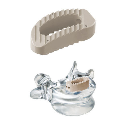 Caja intersomática lumbosacra - pezo™ - ulrich medical - vía lateral / de PEEK