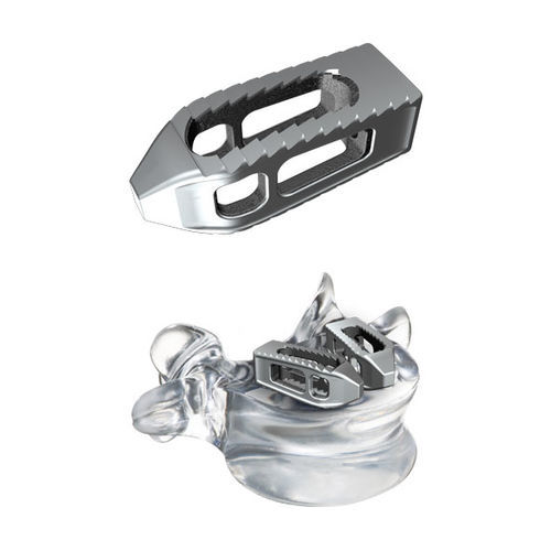 Caja intersomática lumbosacra - tezo™ - ulrich medical - vía transforaminal / de titanio