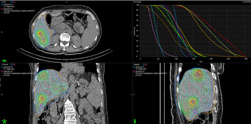 Software de tratamiento - RapidSphere - Varian Oncology - con sistema de seguimiento / de modelado / de contorneo