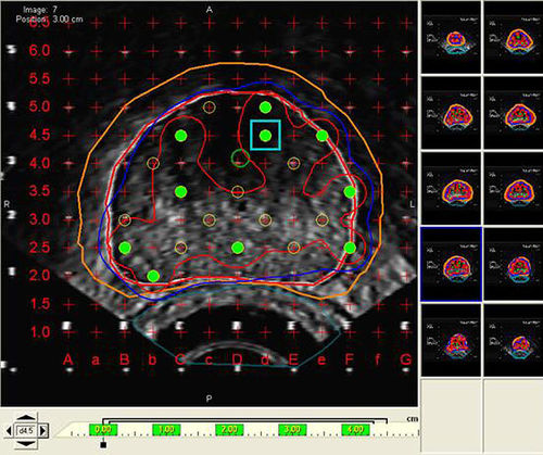 Software de visualización - VariSeed™  - Varian Oncology - de planificación de tratamiento / de importación / médico