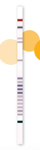 Tira de prueba de HCS - StripAssay® - ViennaLab Diagnostics  - de genes / de sangre / por análisis ADN