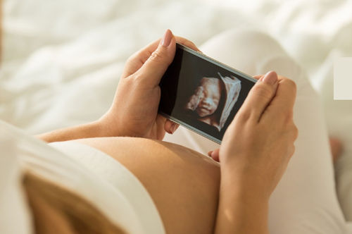 Aplicación web de gestión - Voyager Imaging - de intercambio / visualizador / médica
