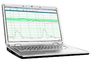 Software de análisis - 902320 - Wallach Surgical Devices - médico / para historias clínicas / de hospital