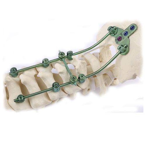 Sistema de osteosíntesis occipitocervical - Double Medical Technology - vía posterior / para adulto
