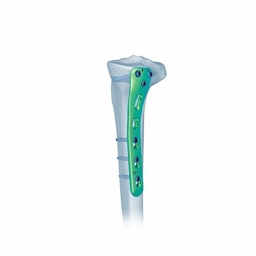 Placa de compresión para tibia - Double Medical Technology - porción proximal / posteromedial / bloqueada