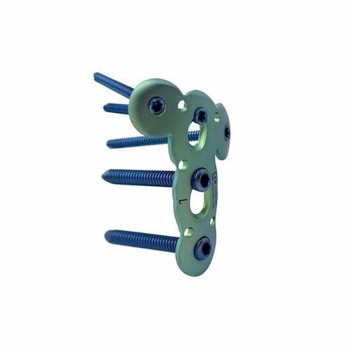 Placa de compresión para húmero - Double Medical Technology - porción proximal / bloqueada / metálica