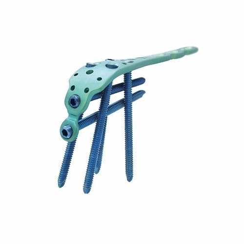 Placa de osteotomía para cúbito - Double Medical Technology - para olécranon / porción proximal / bloqueada