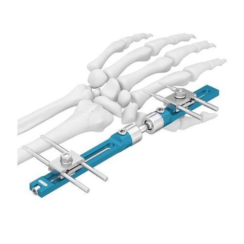 Fijador externo para muñeca - Double Medical Technology - tubular / para adulto
