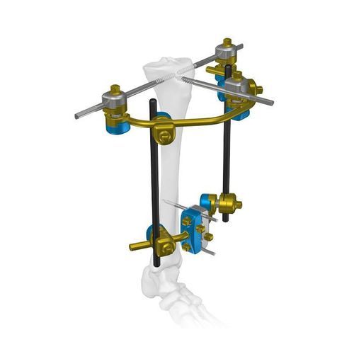 Fijador externo para tibia - Double Medical Technology - para fémur / para húmero / de pelvis