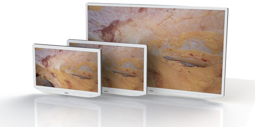 Monitor quirúrgico - XION medical - 32" / 27" / 23,8"