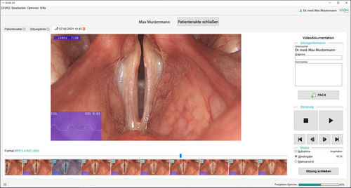 Software de análisis - Phoniatrics - XION medical - médico / para endoscopia / de ORL
