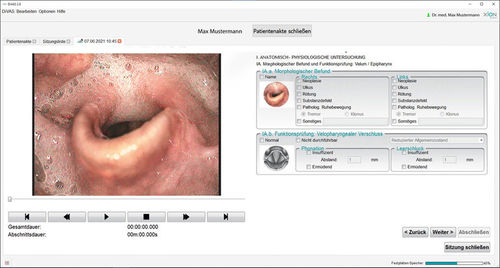 Software médico - Dysphagia - XION medical - para exploraciones médicas / de diagnóstico / de evaluación
