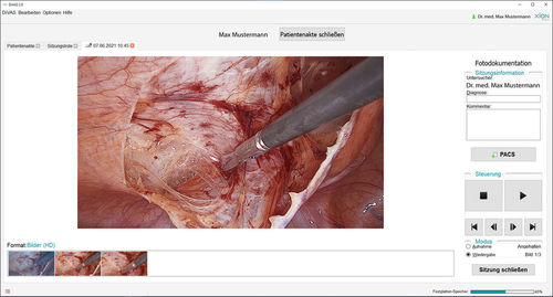 Software de análisis - DiVAS  - XION medical - de visualización / médico / para endoscopia