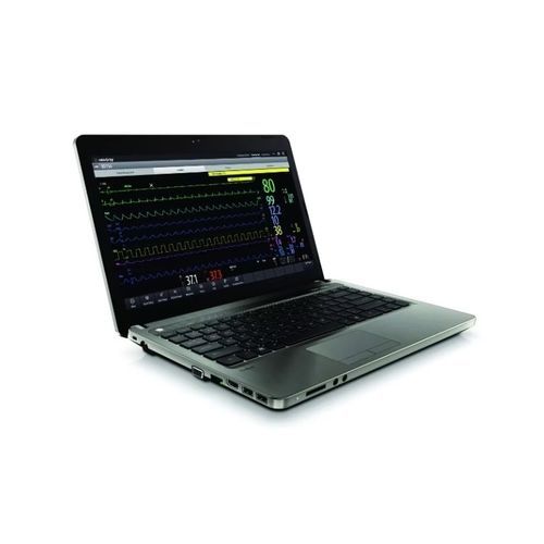 Software visualizador - BeneVision CMS  - Mindray North America - de hospital / para historias clínicas / de gestión de ECG workflow