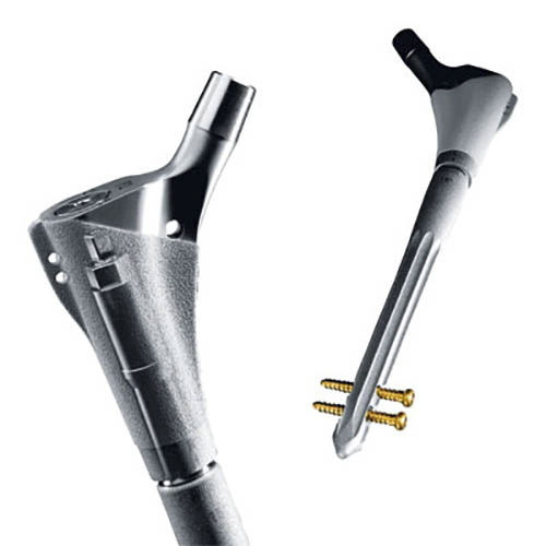 Vástago femoral de revisión - Prevision&reg; - Aesculap® - no cementado