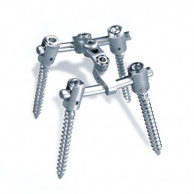 Sistema de osteosíntesis toracolumbar - S4®   - Aesculap® - vía posterior / para adulto