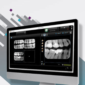 Software de visualización - CS Imaging version 8 - Carestream Dental - de gestión de datos / de gestión de datos de pacientes / de diagnóstico
