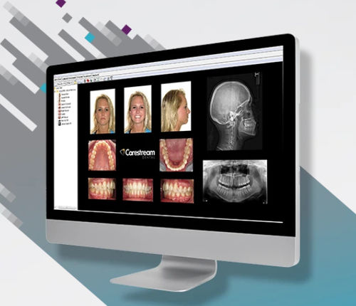 Software de visualización - CS Orthodontic Imaging Software - Carestream Dental - de gestión de datos / de gestión de datos de pacientes / de diagnóstico