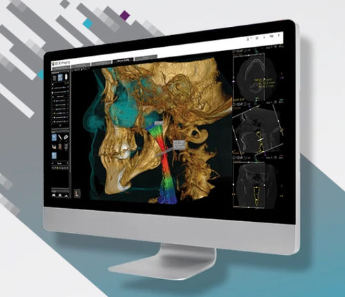 Módulo de software para odontología - CS Airway Module - Carestream Dental - para imágenes médicas / TDM / para imagen dental
