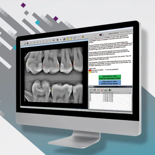 Software de detección de caries - Logicon Caries Detector - Carestream Dental - de visualización / de análisis / de gestión de datos