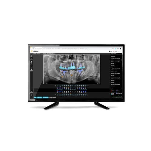 Software de análisis - AI Insights - Carestream Dental - de diagnóstico / para informes / de análisis de imágenes