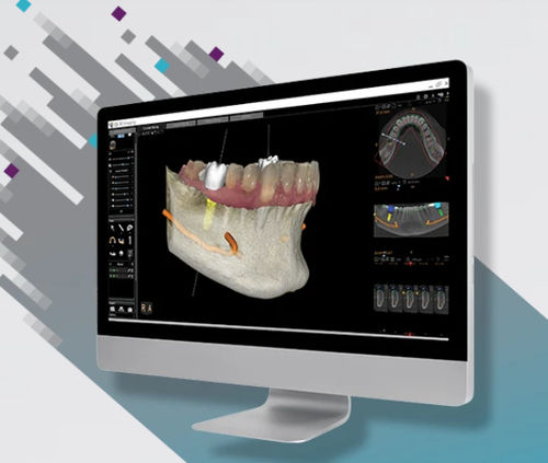 Software de visualización - CS 3D - Carestream Dental - de análisis / de gestión de datos de pacientes / de diagnóstico