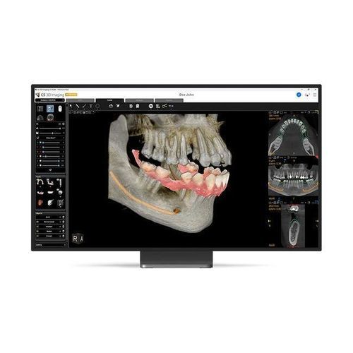 Software clínico - CS 3D Imaging Premium - Carestream Dental - para odontología / de implantología dental / para cirugía dental