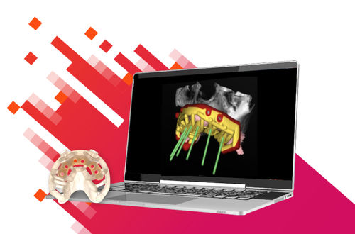 Software de gestión de datos - Stackable - Carestream Dental - de gestión de telecolaboración / de diseño / de planificación