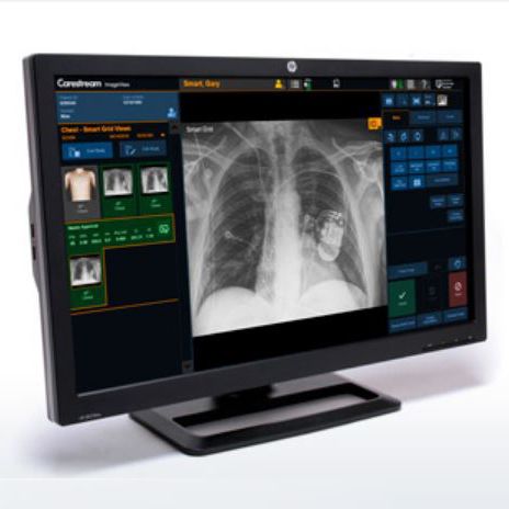 Software para imágenes médicas - ImageView - Carestream - de análisis / de control / de control de infecciones