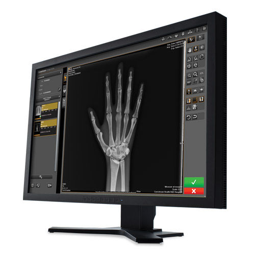 Software de análisis - Image Suite V4 - Carestream - de gestión / de visualización / de adquisición