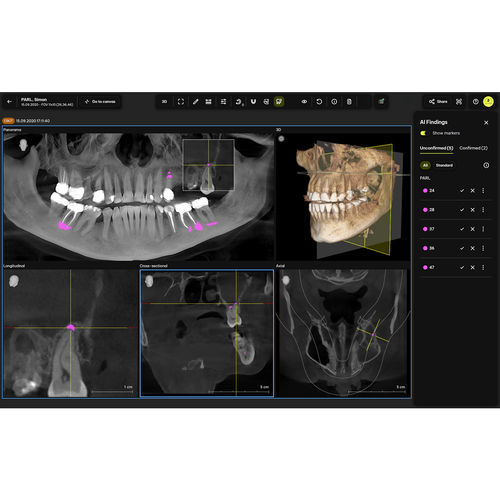 Software de diagnóstico - Smart View – Detect - Dentsply Sirona - de asistencia / de radiografía / de dientes