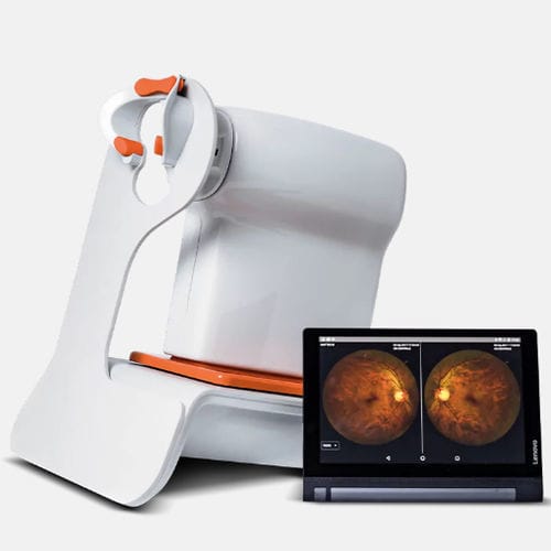 Retinógrafo no midriático - Nexy A.I. - Visionix